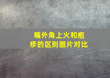 嘴外角上火和疱疹的区别图片对比