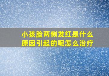 小孩脸两侧发红是什么原因引起的呢怎么治疗