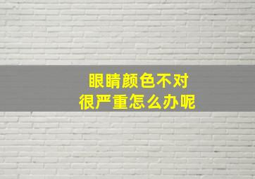 眼睛颜色不对很严重怎么办呢