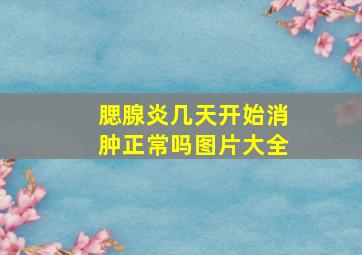 腮腺炎几天开始消肿正常吗图片大全