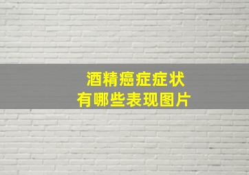 酒精癌症症状有哪些表现图片