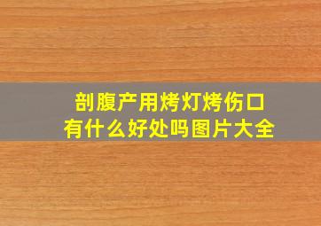 剖腹产用烤灯烤伤口有什么好处吗图片大全