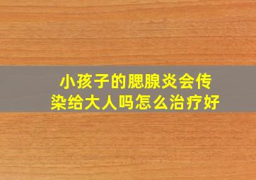 小孩子的腮腺炎会传染给大人吗怎么治疗好