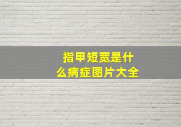 指甲短宽是什么病症图片大全