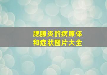 腮腺炎的病原体和症状图片大全